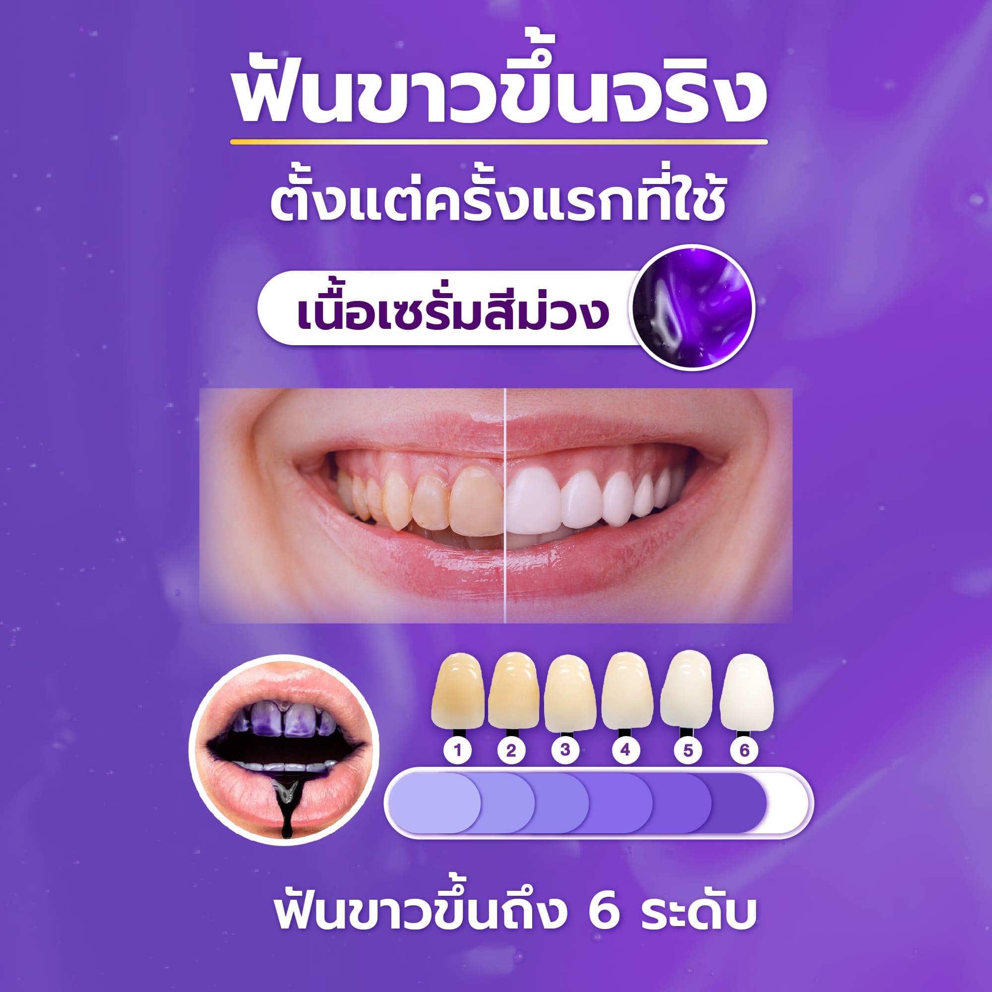 เซรั่มฟันขาว Violet Smile